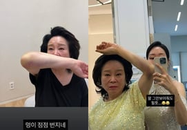 浴室で倒れた『ミジャ母』チョン・ソンエ、事故のその後..「あざがだんだん広がっている」 [スター・イシュー]