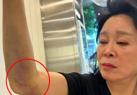 Mija's mother collapsed in the bathroom... covered in bruises on her arm, "Lucky she didn't break any bones at 71" [Star Issue]