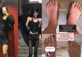 '55kg Weight Loss' Choi Jun-hee, Even Toe Fat Has Disappeared... "Reason for Diet Failure? No Management After Eating"