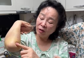 Chun Seong-ae, moretones por todo el cuerpo tras accidente de caída: Mi-ja dice «Perdí el conocimiento, pensé que había muerto»