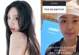 Rapper Lee Young-ji "Cảm thấy tự hào khi được khen về phẫu thuật vùng dưới mắt".. Hài lòng với kết quả, hãy xem ngoại hình