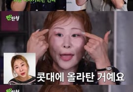 パク・セミ、整形の副作用を告白「鼻の形成と再手術…」前尾に乗る」 [チャンハンヒョン]