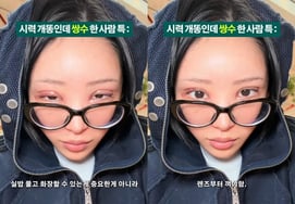 Choi Jun-hee reveals double-eyelid surgery post-marriage; hospital details kept private: "Too swollen to be pretty"
