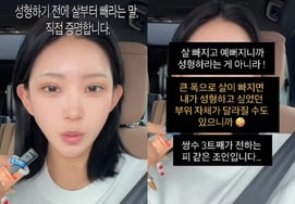 Lần thứ ba chỉ phẫu thuật mắt hai mí..'Giảm 55kg' Choi Jun-hee "Hãy nhất định giảm cân trước khi phẫu thuật thẩm mỹ"[Vấn đề sao]