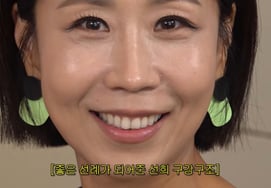 '54 años' Jung Seon-hee, ortodoncia durante un año: «Conocí una alineación dental que el médico, compañero de escuela de Shin Dong-yeop, quería retar» [Rolling Thunder]