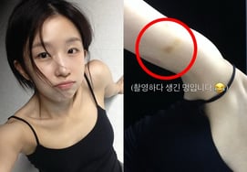 'Jang Ki-ha♥' Yoon Ga-i clarifies 'clear arm bruise' controversy in advance... even performs a 'charisma-emitting' dance challenge [Star Issue]