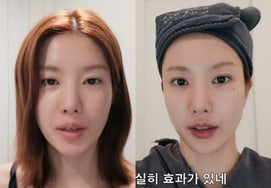 权恩妃,提升术后“面貌焕然一新”.."温达+索夫韦夫确实有效"