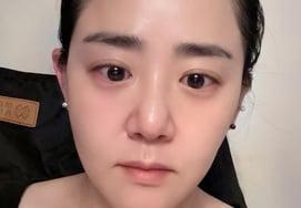Moon Geun-young, "I had fillers" after more difficult appearance following secret marriage with Jung Pyeong...