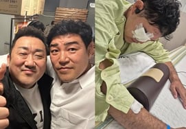 'Ma Dong-seok's Close Friend' Kim Min-su Undergoes Macular Hole Surgery... "Rare Disease, Recovery Process is Difficult" [Star Issue]