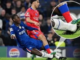 이강인 절친에 밟힌 첼시 수비수, 끔찍한 부상 사진 공개