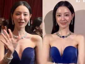 김지원, 뼈말라·건강이상설? 사실 아니었다..다른 영상엔 '러블리 볼살' 그대로 [스타이슈]