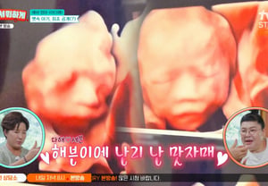 'December Baby' Lee Da-hae Reveals Daughter's Ultrasound: "Her Nose Definitely Resembles Her Dad, Seven" [Left Behind]