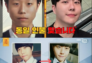 Hombre adicto a la cirugía plástica que gastó 40 millones de wones, al ver el antes y después... ¿por qué le dio sermón Seo Jang-hoon? [Mureobosal] [★BamTV]