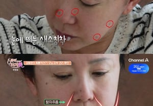 'IU desertora' Kim Hye-young: rostro transformado por arrugas nasolabiales y flacidez de la piel "el paso del tiempo" [Touch Me]