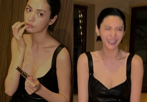 娜娜，争议性填充物被取出？“清冷唇形”再次变薄 [Star Issue]