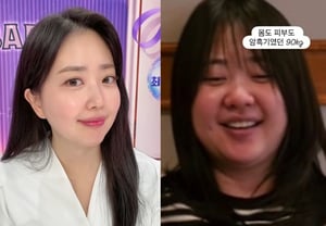 Kim Da-ye: Comparing Her Past Photos at 90 kg, "Both My Body and Skin Were in a Dark Period"