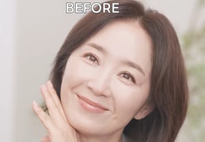 Yoon Yoo-sun, de 58 años, confiesa sus tratamientos faciales y hasta sus dudas sobre una cirugía de nariz: "Siento que mi rostro es plano"