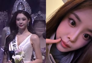 «Controversia por cirugía estética»: Woo Seo-yoon, confesión serena sobre tratamiento dental: «Lo que más me satisface, la sensación es muy buena» [Star Issue]
