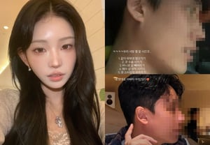 Choi Jun-hee: «Hasta le hice cirugía nasal a mi esposo, que es 11 años mayor que yo»: «Lo arreglo a mi manera»