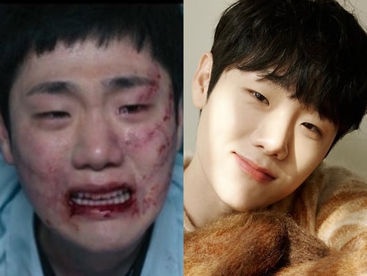 기사 이미지