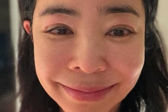 李慧英坦言与病魔作斗争后脸肿的近况"目标是恢复健康"