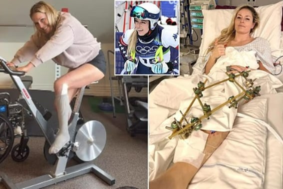 "冲击"双腿截肢危机→大手术连续5次→不到一个月就到了？ 震惊世界的恢复力"虽然很痛苦...""