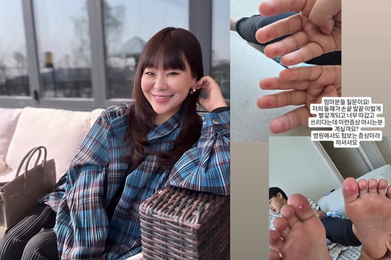 "Mother of Five Brothers" Jung Ju-ri, Parenting SOS, "The symptoms I've never seen before even in hospitals."