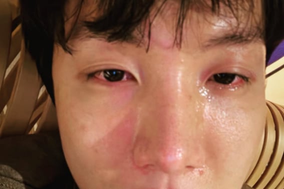 BTS J-Hope, red eyes and puffy face in tearful selfie... "Grandmother passed away after arriving in Japan"