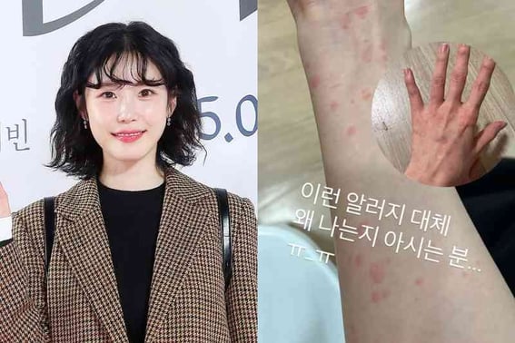 Jeon Hyo-sung reveals health issues for the fourth month: "Waiting for blood test results" [Star Issue]