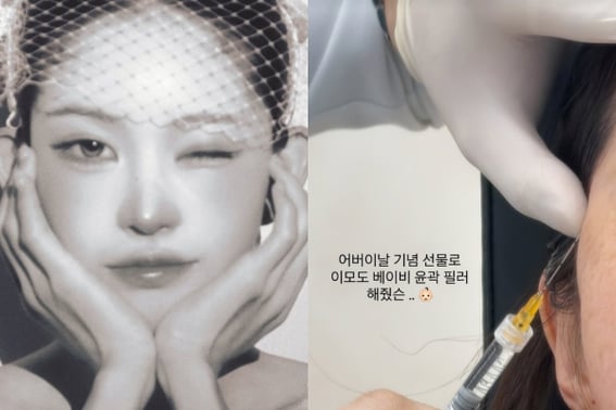 Cùng với dì.Món quà "Kỷ niệm Ngày Cha Mẹ" của Choi Joon Hee là phẫu thuật thổi sáo. [Star Issue]