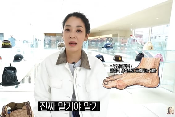 Han Go-eun's Husband, Unemployed for Seven Years, Suffers from Late-Stage Bunion: "Even a Breeze Hurts" [Star Issue]