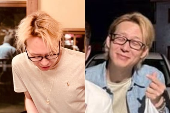 Park Yoo Chun gây sốc với mái tóc chẻ ngọn và khuôn mặt nhăn nheobom tấn công trực tiếp theo thời gian [Star Issue]