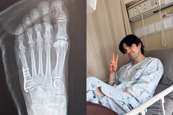 Robin shares sad news of a "metatarsal fracture"..."French hospitals are truly slower and less convenient than Korean ones"