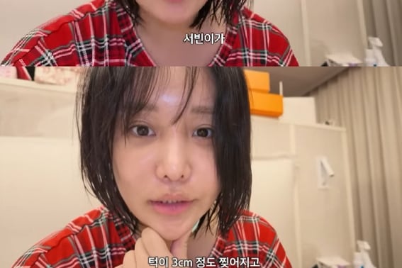 Lalalal đau lòng trước tai nạn của con gái Seo BinCó thể làm tổn thương răng vĩnh viễn".