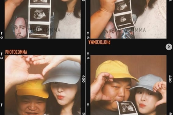 'Embarazada tres años después del matrimonio' Aimin, ♥con fotos de ultrasonido junto a Ko Kyu-pil, emocionada: "Hasta que nos veamos en diciembre"