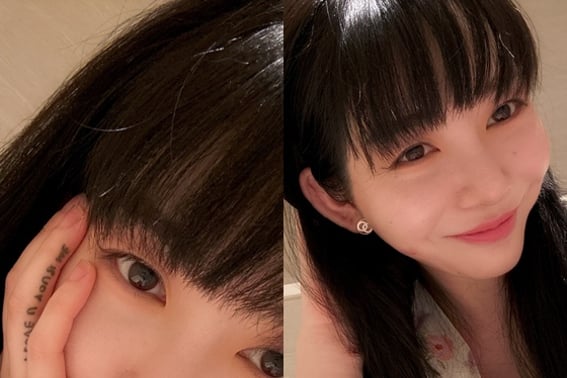 「被害金1億」主張のクォン·ミナ、シュリンク医療事故→6か月で傷跡回復？ [スター・イシュー]