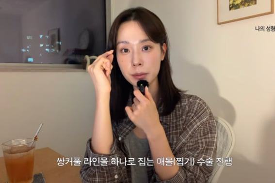 'Hush 4' Lee Ju-mi, the reason she suddenly looked different... "Double eyelid and under-eye fat relocation surgery" [Star Issue]
