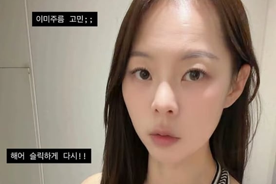 Thế hệ 28 Young-ja, sau khi ly hôn lần hai với Young-chul chỉ 6 tháng..công khai nỗi lo bất ngờ "nếp nhăn trán" [Star Issue]