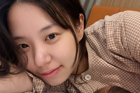 'Choi Hyun-seok's daughter' Choi Yeon-soo on why she stopped breastfeeding: "My chest shape changed, causing depression... but I have no regrets" [Star Issue]