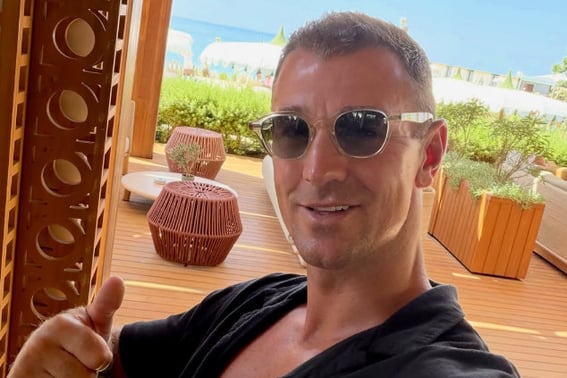 '2,500-hair transplant' a huge success → handsome transformation! Joe Hart: "Quit as shampoo model due to hair loss... Now I have the 'choice' of style"