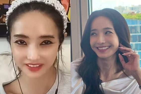 'Health Concerns' Han Chae-young, After Removing Witch Makeup, Returns with 'Peak Beauty'