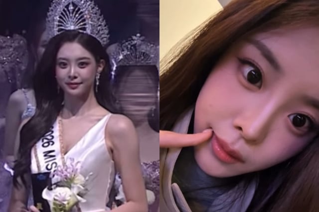«Controversia por cirugía estética»: Woo Seo-yoon, confesión serena sobre tratamiento dental: «Lo que más me satisface, la sensación es muy buena» [Star Issue]