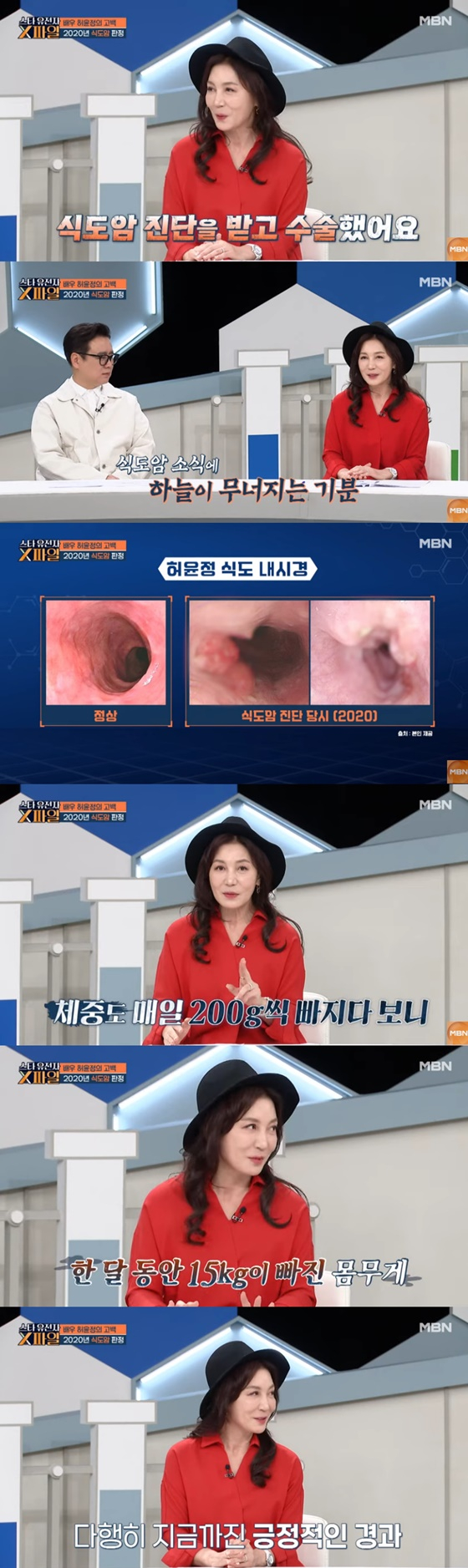 /사진=MBN