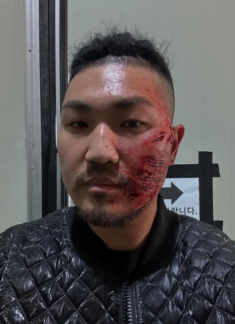/사진=던밀스 SNS