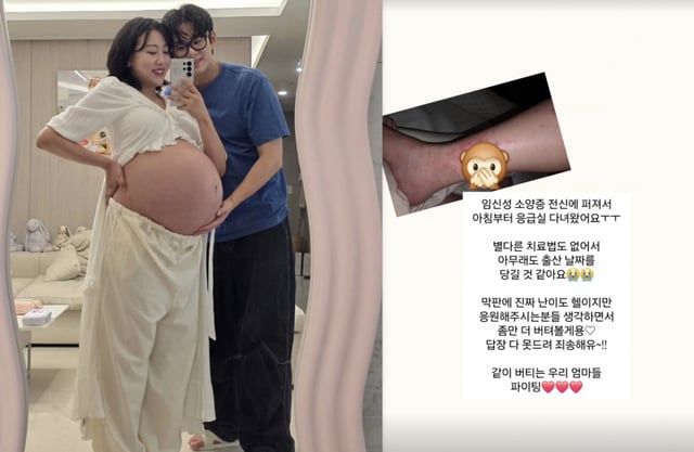 /사진=임라라 SNS