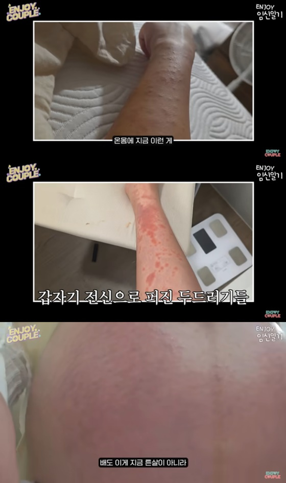 /사진=엔조이커플