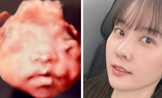 배우 최참사랑 /사진=양현민 SNS