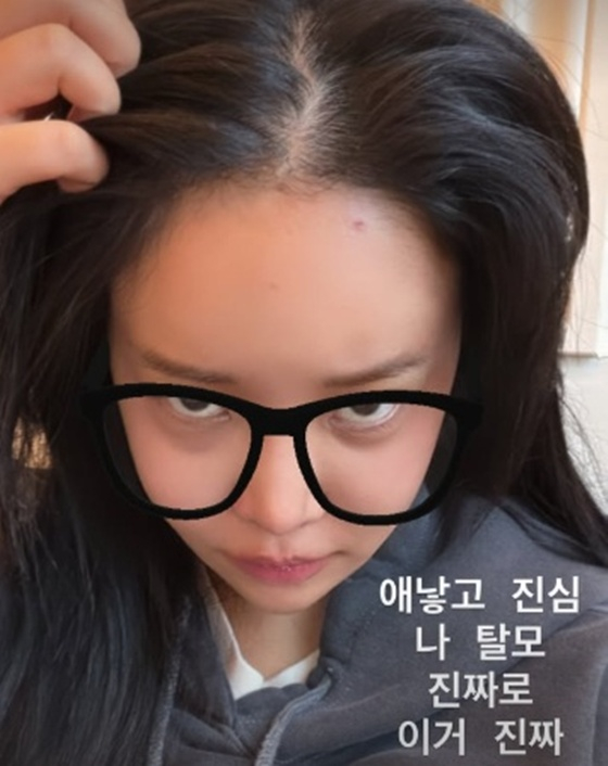 /사진=랄랄 SNS