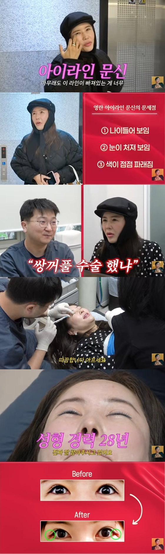 /사진=유튜브 채널 'A급 장영란'