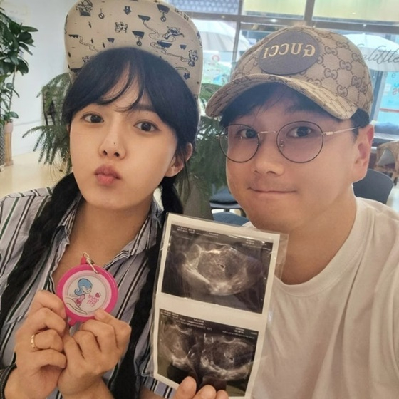 강은비 부부/사진=강은비 SNS